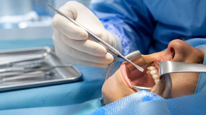Surgeon using an Obwegeser periosteal elevator during a clean dental procedure with no visible blood or graphic surgical details.